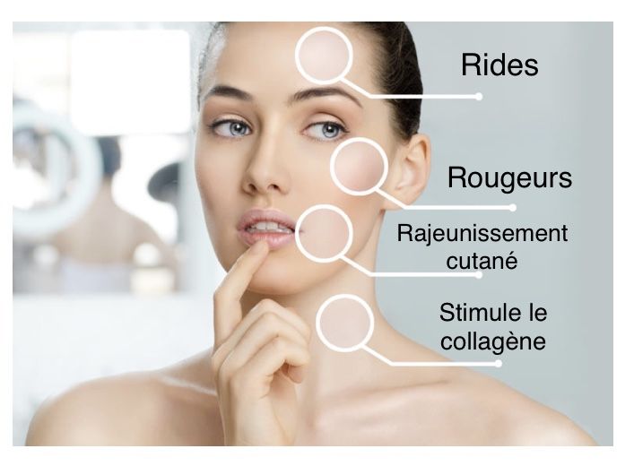 Tarif épilation définitive visage menton cou lèvre moustache sans douleur avec première consultation offerte à Paris 15 Boulevard de Montparnasse