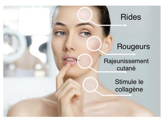 En quoi consiste le photo rajeunissement ? réponse de votre centre expert beauté de Paris 14