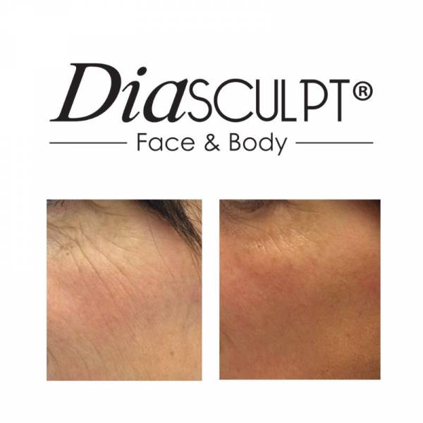 soin visage anti-âge naturel à Paris 14 Montparnasse