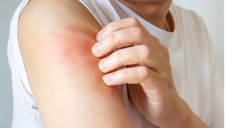 Quelle épilation définitive choisir quand on a la peau sensible ? Réponse de votre expert ByVinca de Paris 14