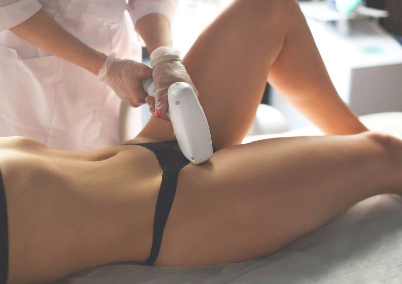 Séance d’épilation définitive du maillot à la lumière pulsée à Paris 14