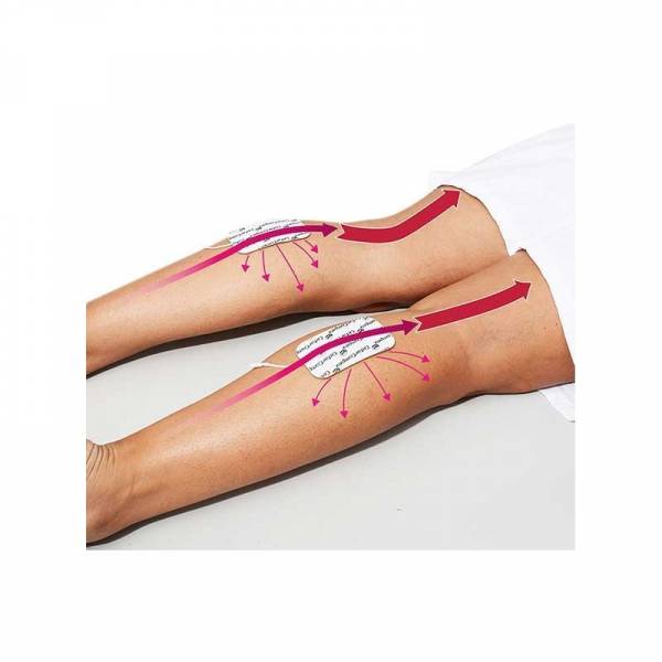 Optimiser les résultats des la cryolipolyse à Paris 14 Denfert