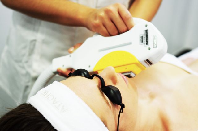 Epilation à la lumière pulsée du visage à Paris 14